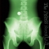 The Pelvis Douglas